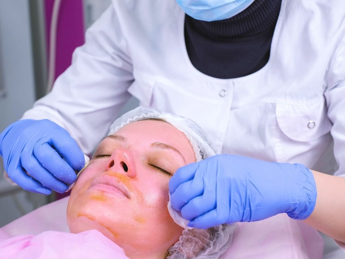 girl getting a strong chemical peel at a skin clinic